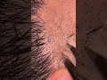 めちゃ太い髭32