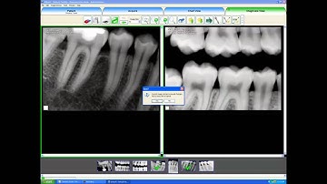 EVAsoft Diagnosis View Tab