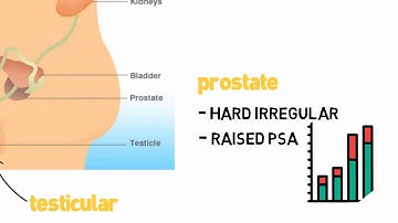 MRCGP Crammers: Urology 2WW referrals