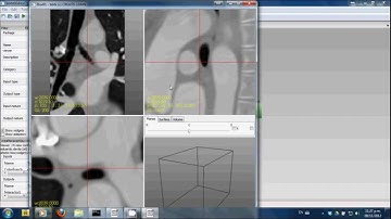 BBEditor Video Tutorial Series - 1.3.Building a Simple Pipeline