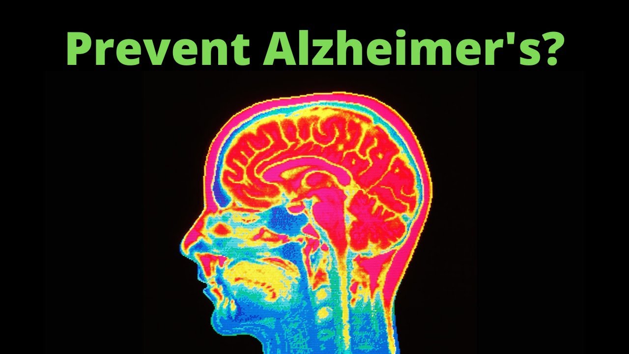 This Company can prevent Alzheimer's? (Stock Analysis)