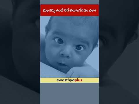 మెల్ల కన్ను ఉందో లేదో తెలుసుకోవడం ఎలా? | Symptoms of Squint Eyes in children | Dr Aloka Hedau