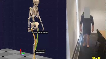 EMG signals with synchronised video