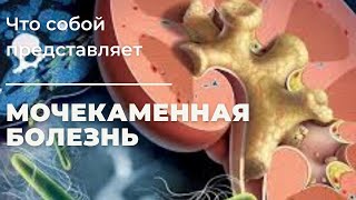 Мочекаменная болезнь лекция для студентов (рус)