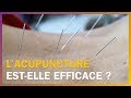 Lacupuncture estelle efficace 