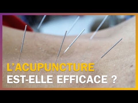 Vidéo: Types De Prestataires Qui Pratiquent L'acupuncture