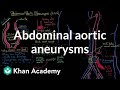 Abdominal aortic aneurysms | Circulatory System and Disease | NCLEX-RN | Khan Academy