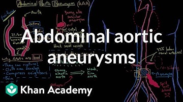 Abdominal aortic aneurysms | Circulatory System and Disease | NCLEX-RN | Khan Academy