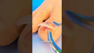 कय हग जब नखन म चट लग जए