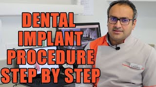 Dental Implants Procedure Step by Step || How Dental Implants are Put In || Dental Implant Surgery