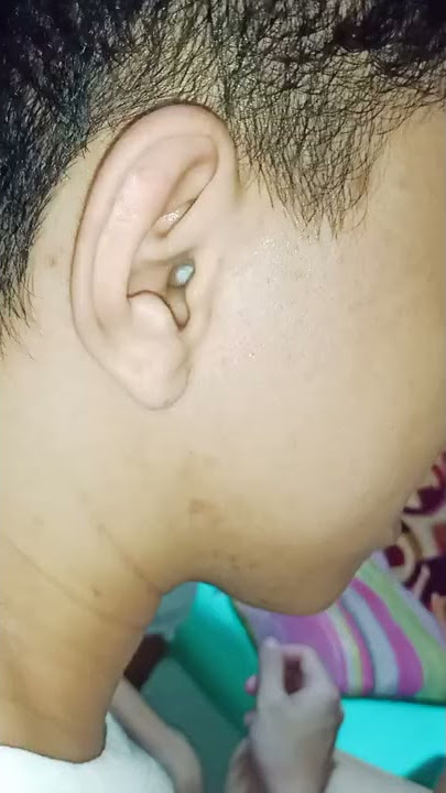 HOW TO REMOVE COTTON FROM EAR