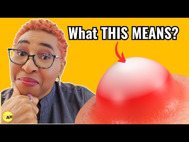 Katta Dik bilan anal jinsiy aloqa video Qizilyurt fohishalari