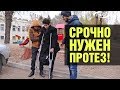 Юноша потерял ногу. Срочно нужен протез!