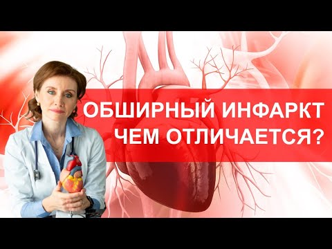 Видео: Защо кома след инфаркт?