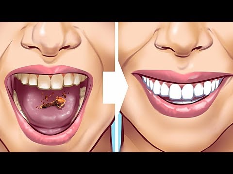 فيديو: 5 طرق للحفاظ على أسنانك اللثة صحية لصحة الحياة