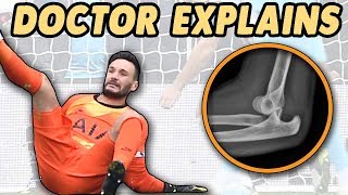 Celebrity Doctor's Guide to Hugo Lloris Elbow Dislocation Profile
