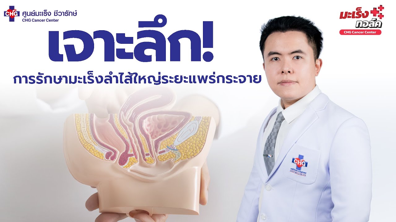 เจาะลึก! การรักษามะเร็งลำไส้ใหญ่ระยะแพร่กระจาย