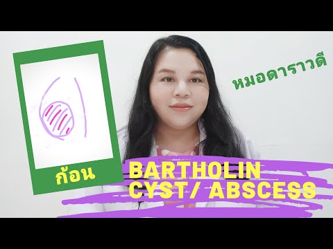 ตอบคำถาม ถุงน้ำที่ต่อมบาร์โธลิน Bartholin cyst | abscess by หมอดาราวดี