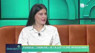 Çfarë është myku i thonjve Sidita Boriçi, Dermatologe | “ShëndetSi” në RTSH