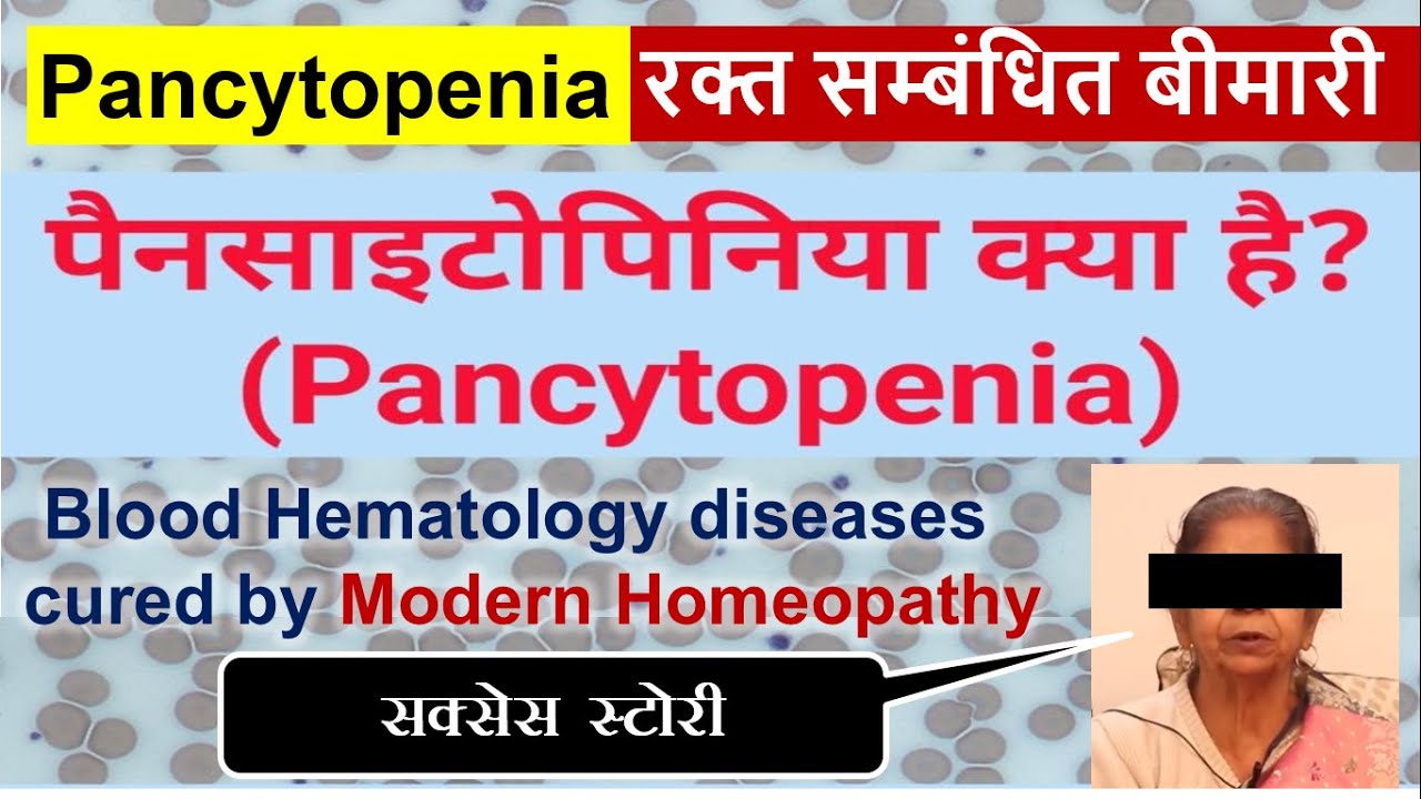 Pancytopenia Rheumatoid Arthritis Critical Patient Cured Dr. Arpit