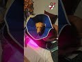 Ariel is recovering from difficult surgery - her third surgery on her legs ❤️🩹🐾