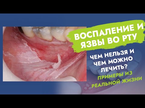 Video: Co je jednotnost obsahu ve farmacii?