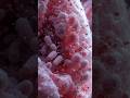 Ultra-Realistic Lung Infection Healing | 3D Medical Zoom Animation#LungInfection #MedicalAnimation
