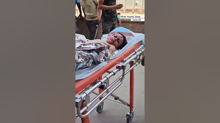 Children suffered severe burns in an Israeli strike in Gaza