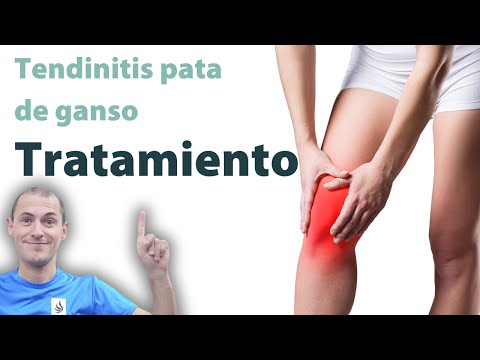 Tendinitis de la pata de ganso - Tratamiento con ejercicios, automasajes y estiramientos