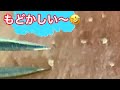 【角栓ピンセット】#毛穴#毛穴レス #毛穴ケア最後が....ピンセットで1つづつ 取る☝️