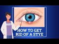 What Is A Stye and How Do You Get A Stye?
