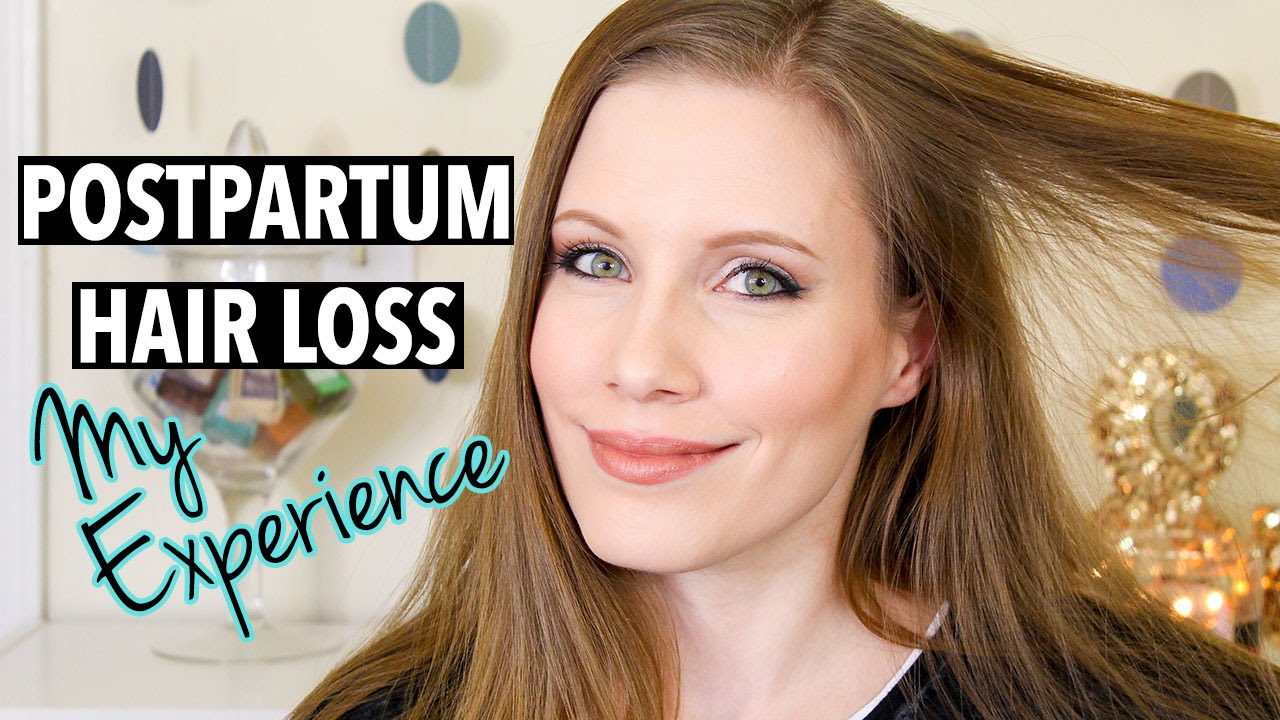 Postpartum Hair Loss My Experience YouTube