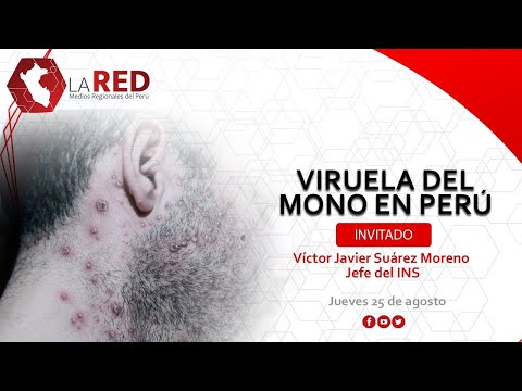Viruela del mono: Perú lidera contagios en Latinoamérica | Red de Medios Regionales del Perú