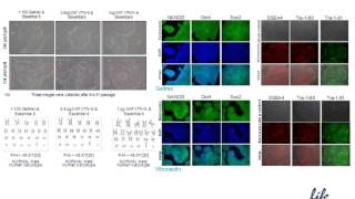 Considerations for the culture of pluripotent stem cells