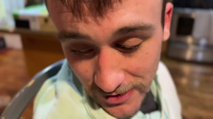 draining cauliflower ear