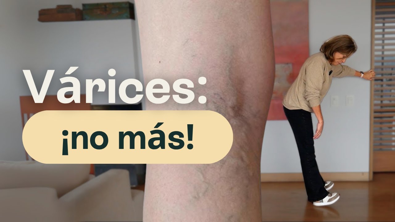 ¡NO MÁS VÁRICES! Haz esta RUTINA para activarlas piernas