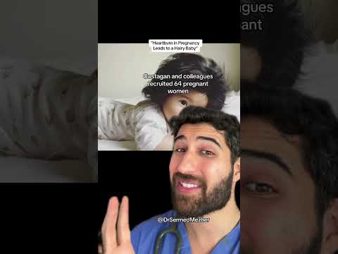 Heartburn In Pregnancy Leads To A Hairy Baby Research 