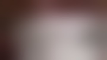 Hernia TAPP surgery with self gripping mesh