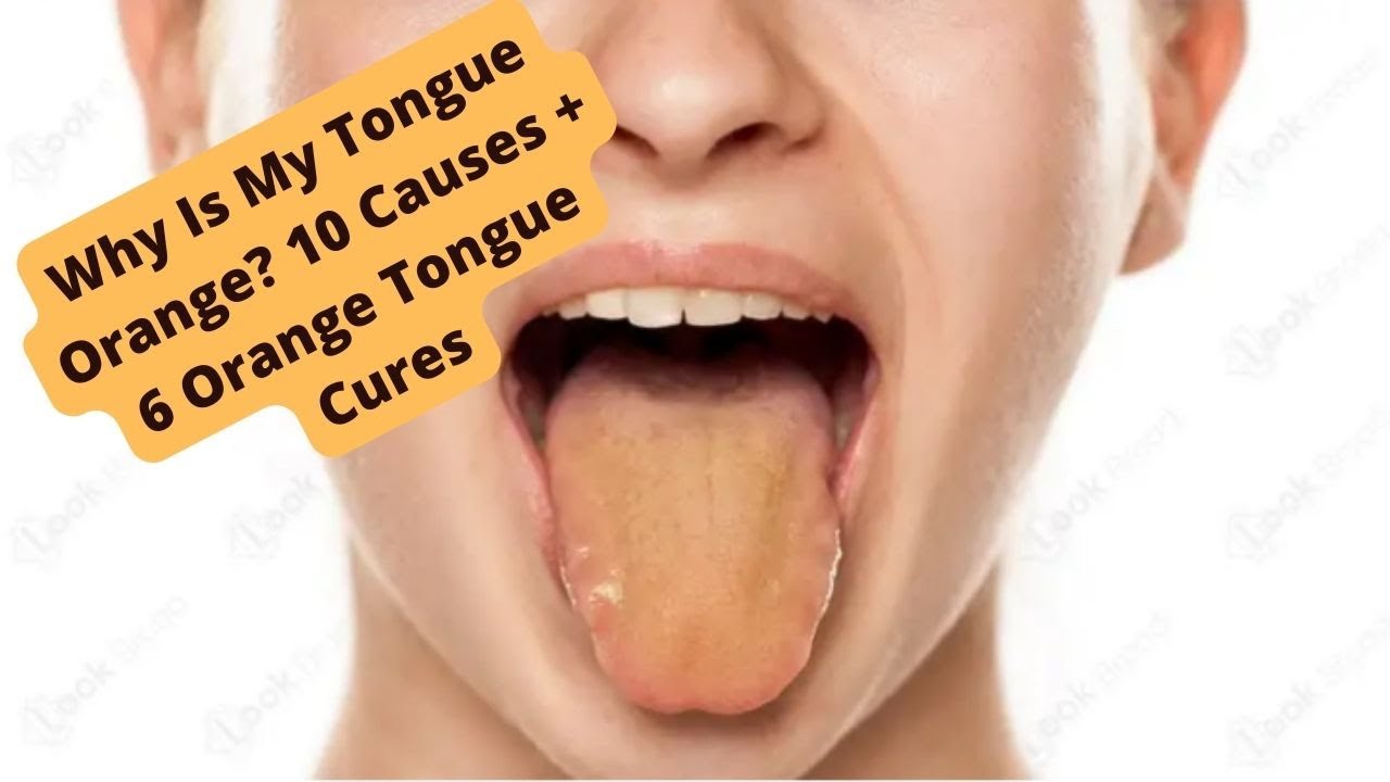 Why Is My Tongue Orange? 10 Causes + 6 Orange Tongue Cures