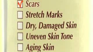 TRENDS Skin Therapy Oil Draft#2 MP4 768Kbps WMV 768Kbps