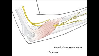 The Posterior Interosseous Nerve Deep Branch Of Radial Nerve And Effect Of Its Lesion Damage