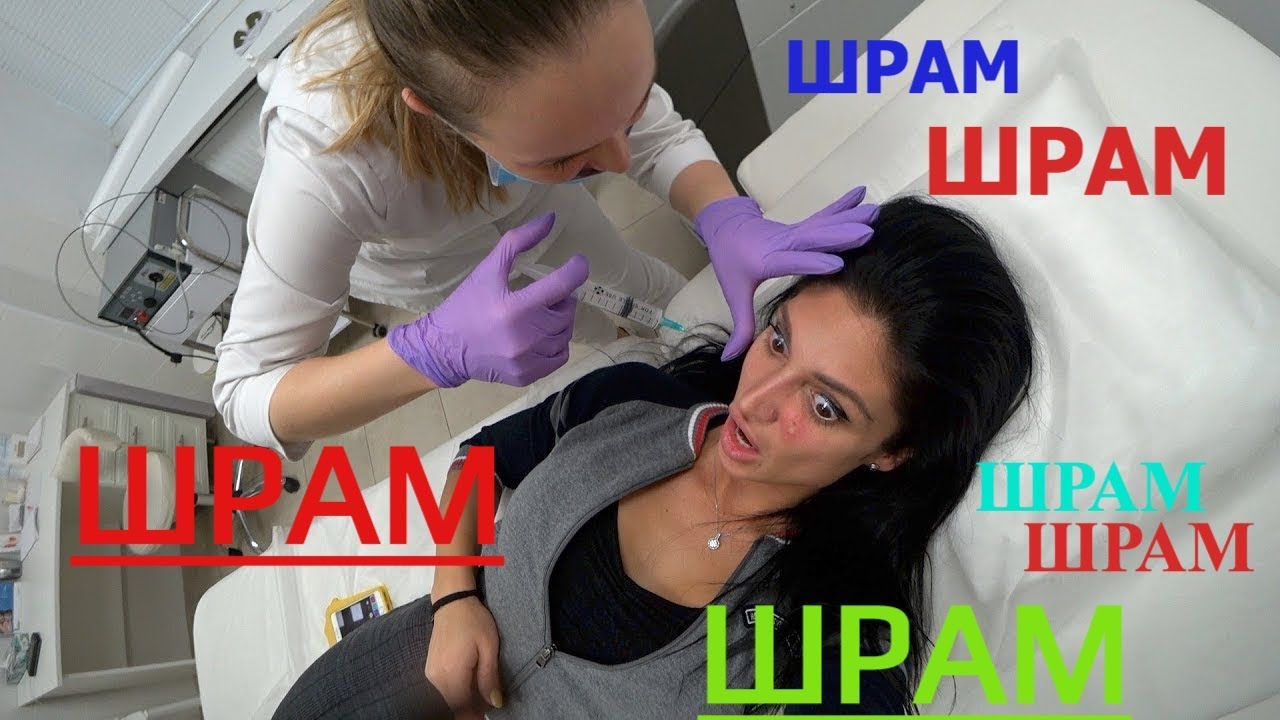 ПЕРВОЕ УДАЛЕНИЕ ШРАМА