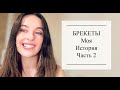 Брекеты - Моя история. Выводы и результаты. Часть 2