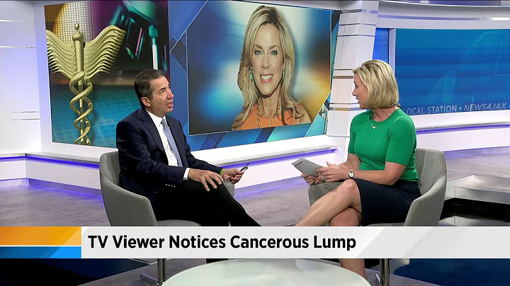 Dr. Scot Ackerman discusses cancer on thyroid