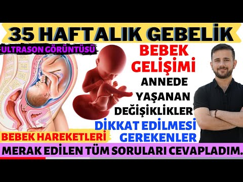 Video: 35 Haftalık Hamilelik: Duyular, Fetal Gelişim