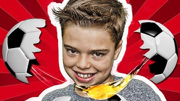 Easy 1 Minute Zach King Ball to Fried Egg Trick