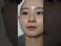 ずっと気になっていたラミチェ!今回私がしてもらった7つはインモードフラクセルデュアルエクセルブイウルセラニューアコレード スキンボトックススキンボトックス 毛穴#ラミチェ皮膚科 #韓国皮膚科 #PR