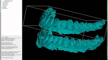 Using Afanche3D to process 3D dental model