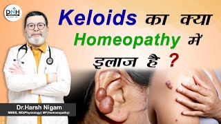 Keloids का क्या homeopathy में इलाज है ? || keloids ka kya homeopathy mey ilaj hai screenshot 5