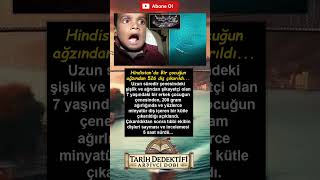 Bir Insanın Kaç Dişi Olabilir??? Ş Iz